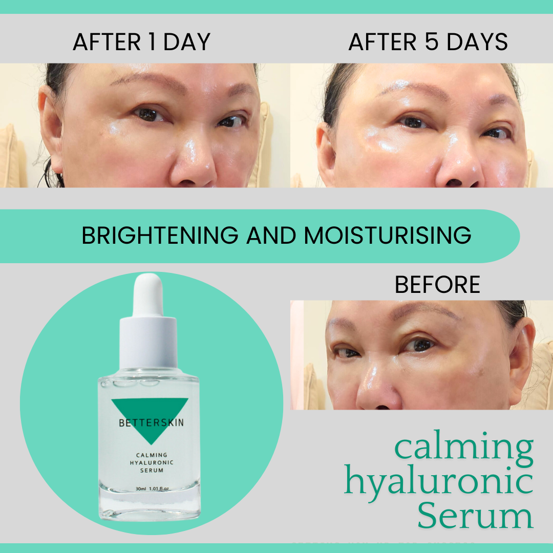 CALMING HYALURONIC SERUM